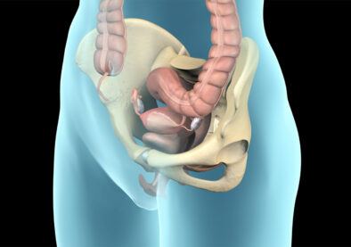 Pelvic Prolapse