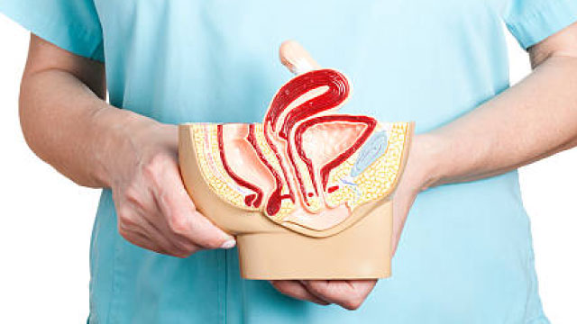 Prolapse